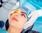 آیا جراحی چشم شامل بیمه تکمیلی می‌شود؟