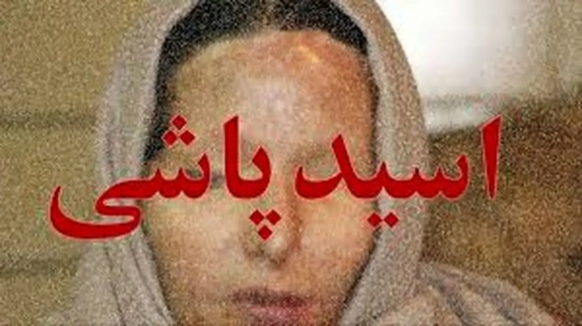 اخبار حوادث | اسیدپاشی وحشیانه به صورت دختر جوان در تهران | جزئیات اسیدپاشی ظالمانه در طرشت